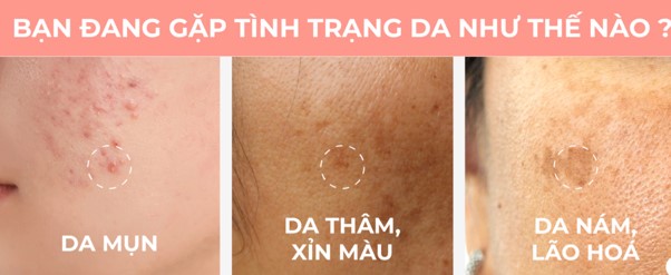 Am to PM: Giải mã xu hướng “healing science” chữa lành và tái tạo nền da nhạy cảm